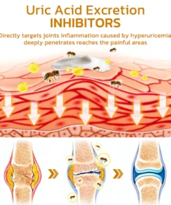 flysmus™ Bee Venom Hyperuricemia Anti-Infection Cream