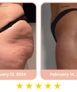 flysmus™ CurvesSculptor Enhancement Patch