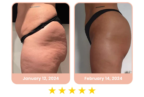 flysmus™ CurvesSculptor Enhancement Patch