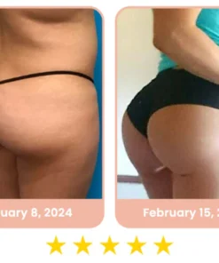 flysmus™ CurvesSculptor Enhancement Patch