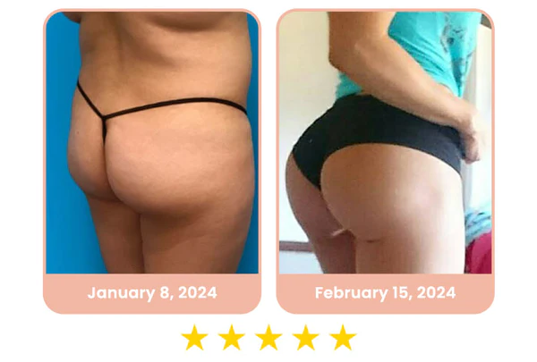 flysmus™ CurvesSculptor Enhancement Patch