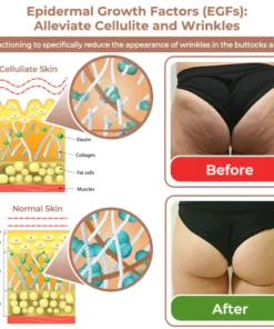 flysmus™ CurvesSculptor Enhancement Patch