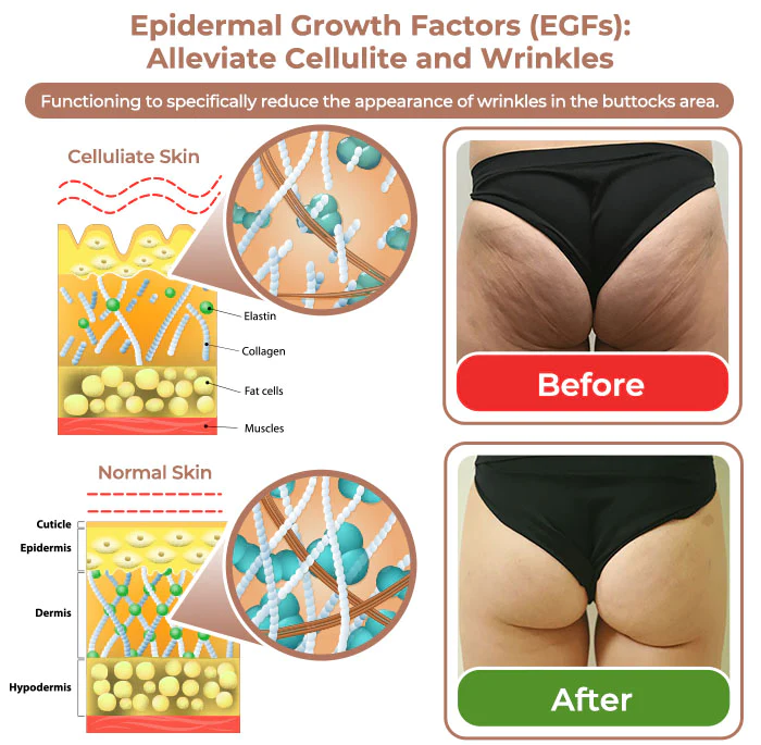 flysmus™ CurvesSculptor Enhancement Patch