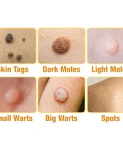 flysmus™ TagRecede Bee Venom Treatment Spray