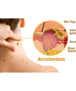 flysmus™ TagRecede Bee Venom Treatment Spray