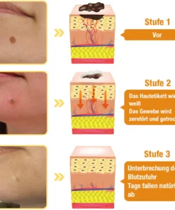 flysmus™ TagRecede Bienengift Behandlungsspray