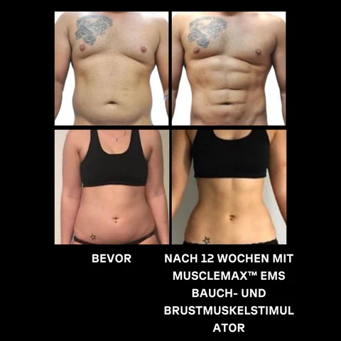 AEXZR™ EMS Bauch - ومحفز Brustmuskel