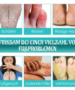 Biancat™ FreshStride Fortschrittliches مضاد التعرق Fußpflegespray