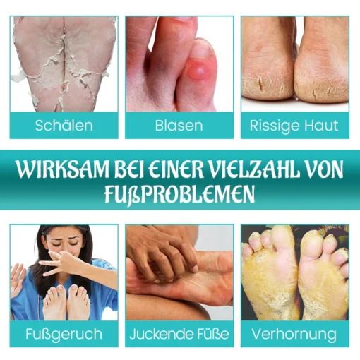 Biancat™ FreshStride Fortschrittliches مضاد التعرق Fußpflegespray