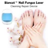 جهاز Biancat™ لإصلاح فطريات الأظافر بالليزر