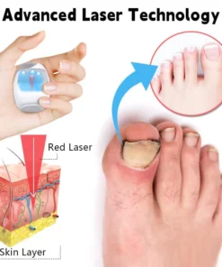 Biancat™ Nail Fungus Laser Cleaning Repair Device