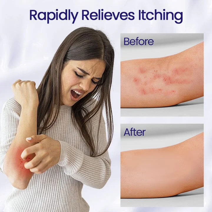 كريم Ceoerty™ العشبي المضاد للبكتيريا