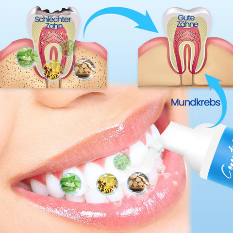 موس Ceoerty™ Deluxe Kräuter Mundpflege