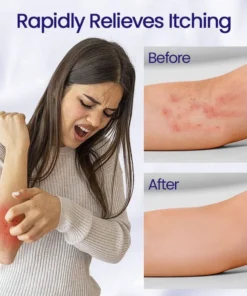 Ceoerty™ Antibacterial Herbal Cream