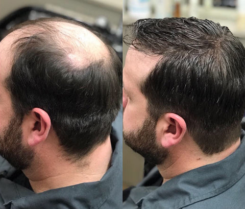 Ceoerty™ BiotinLuxe Haarwuchs-Essenz Spray