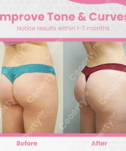 Ceoerty™ BumUP Bee Venom Butt Enhancer Cream