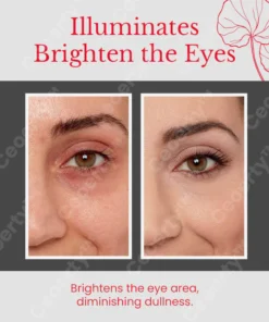 Ceoerty™ Luminance Eye Rejuvenating Cream