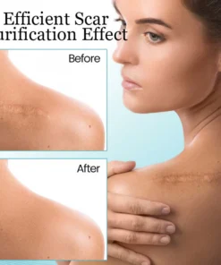 Ceoerty™ Skin Renewal Scar Spray