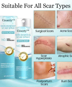 Ceoerty™ Skin Renewal Scar Spray