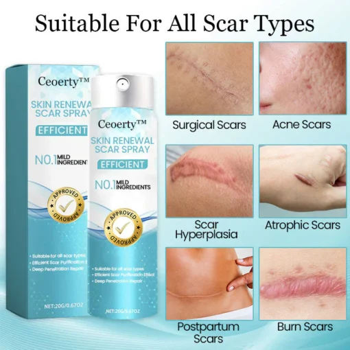 Ceoerty™ Skin Renewal Scar Spray