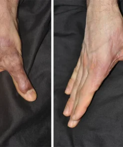 Ceoerty™ Skin Renewal Scar Spray