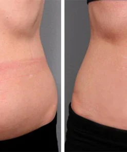 Ceoerty™ Skin Renewal Scar Spray