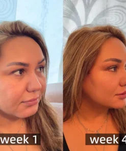 Cvreoz™ Bee Venom Foot Sole Acupoint Drainage Health Patch