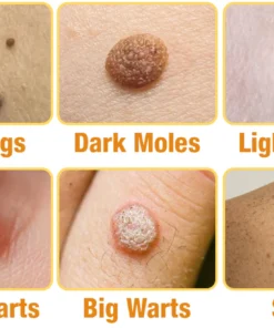 Dobshow™ Bee Venom Skin Perfection Spray: Erase Tags & Warts Naturally