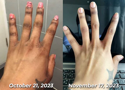 Dobshow™ ShineLuster Bee Venom Clinical Strength Soap for Skin Clarity