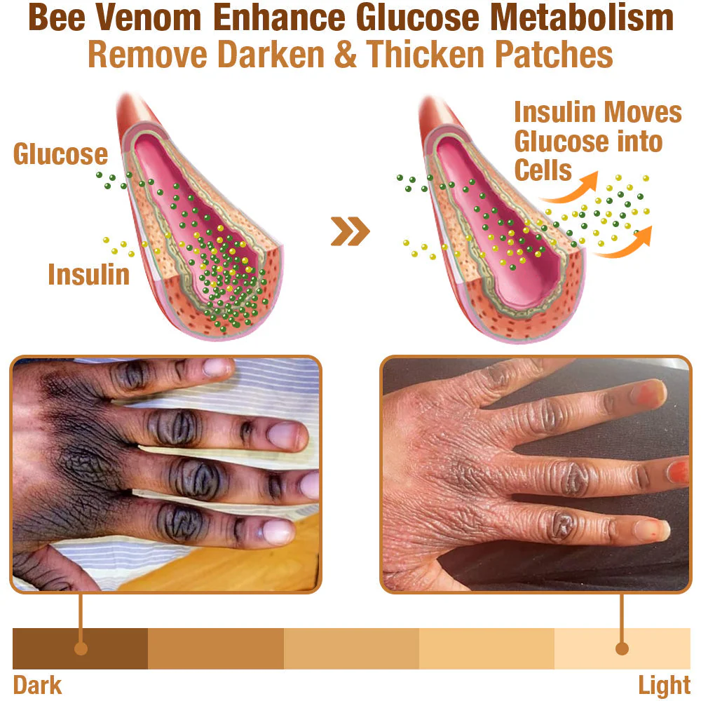 Dobshow™ ShineLuster Bee Venom Clinical Strength Soap for Skin Clarity