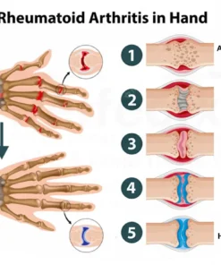 Fivfivgo™ FlexiCure Gelenk- und Knochentherapie-Creme