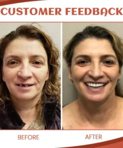 مجموعة Fivfivgo™ PerfectFit Prothese Silikon Reline