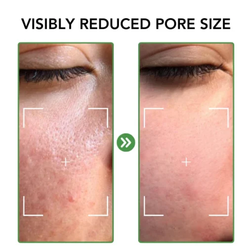 مجموعة Fivfivgo™ Porenminimierer Essenz