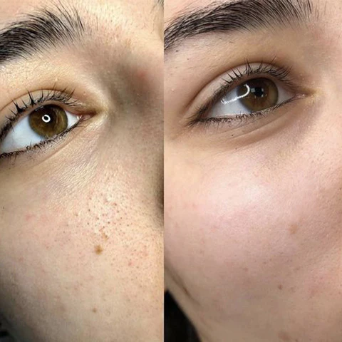مجموعة Fivfivgo™ Porenminimierer Essenz