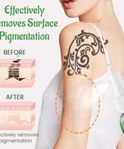 Fivfivgo™ PureSkin Tattoo-Entfernungs-Creme