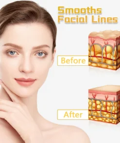 جهاز Fivfivgo™ UltraRenew لشد الوجه بالموجات فوق الصوتية