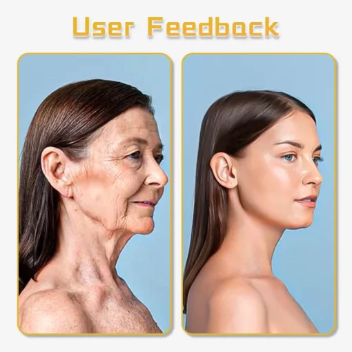 جهاز Fivfivgo™ UltraRenew لشد الوجه بالموجات فوق الصوتية