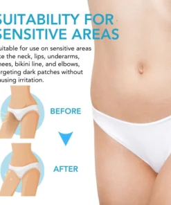 Fivfivgo™ Acanthosis Nigricans Aufhellungscreme