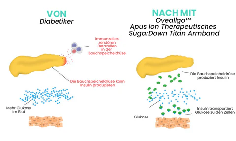 Fivfivgo™ Apus Ion Therapeutisches SugarDown Titan Armband