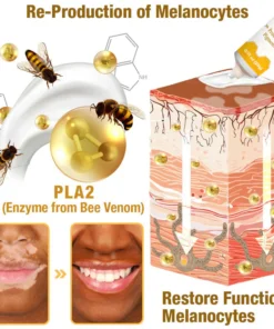 Fivfivgo™ BeeVenom Vitiligo Behandlung Creme
