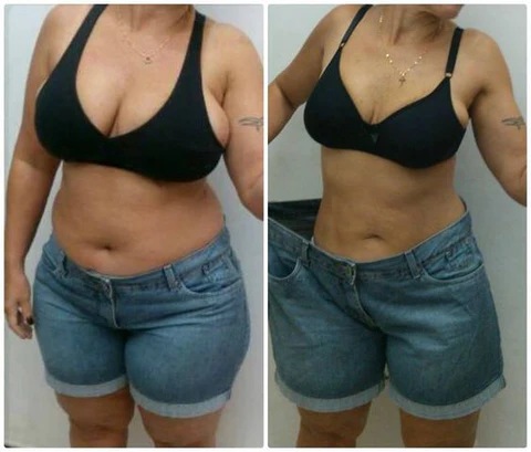 Fivfivgo™ BodySculpt Bauchschmelzendes Spray - Image 6