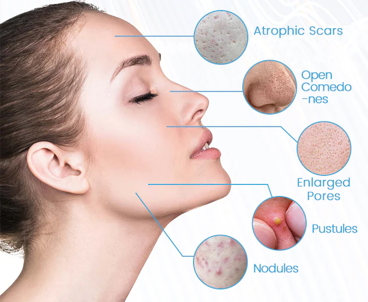 Fivfivgo™ ClariSkin 2% Salicylsäure Ausgleichendes Reparaturserum