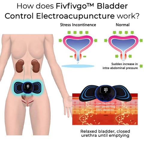 Fivfivgo™ Elektroakupunktur zur Kontrolle der Blase
