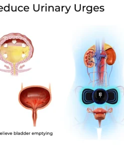 Fivfivgo™ Elektroakupunktur zur Kontrolle der Blase