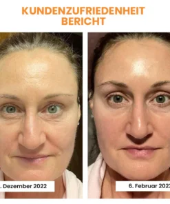 Fivfivgo™ Koreaanse Dermalayr Technology Oplosbare Collageenfilm