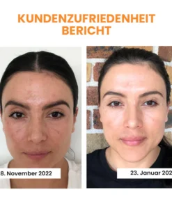 Fivfivgo™ Koreaanse Dermalayr Technology Oplosbare Collageenfilm