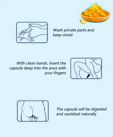 Fivfivgo™ Natürliche pflanzliche Stärke Hämorrhoiden-Kapseln