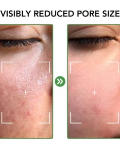 Fivfivgo™ Porenminimierer Essenz-Set