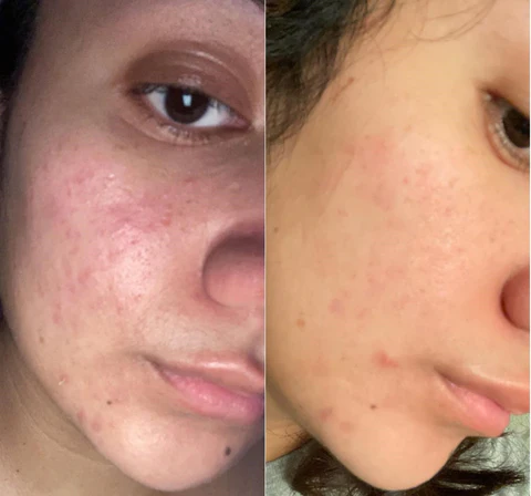 Fivfivgo™ Porenminimierer Essenz-Set