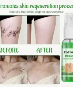 Fivfivgo™ PureSkin Tattoo-Entfernungs-Creme